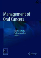 Management of Oral Cancersمدیریت سرطان های دهان