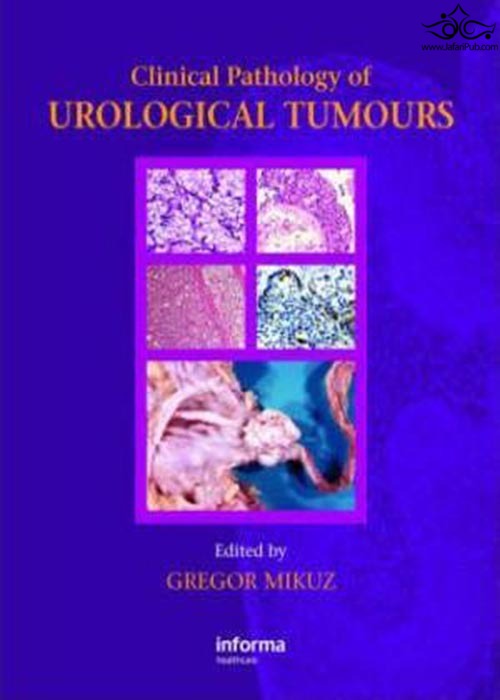 Clinical Pathology of Urological Tumours2007 Taylor & Francis Ltd
