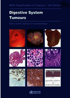 WHO Classification of Tumours. Digestive System Tumours : WHO Classification of Tumours | طبقه بندی تومورهای دستگاه گوارش