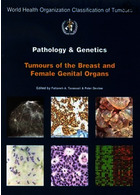 Pathology and Genetics of Tumours of the Breast and Female Genital Organs2003