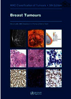 WHO Classification of Breast Tumours : WHO Classification of Tumours, Volume 2
