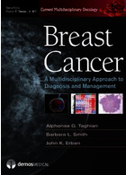 Breast Cancer : A Multidisciplinary Approach to Diagnosis and Managementسرطان پستان: رویکرد چندرشته ای در تشخیص و مدیریت