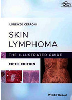 Skin Lymphoma : The Illustrated Guideلنفوم پوستی: راهنمای مصور
