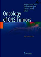 Oncology of CNS Tumorsانکولوژی تومورهای CNS