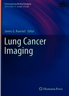 Lung Cancer and Autoimmune Disordersسرطان ریه و اختلالات خود ایمنی