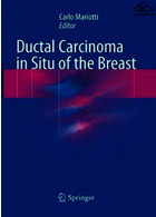 سرطان مجاری در وضعیت سینه | Ductal Carcinoma in Situ of the Breast2018