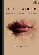 سرطان دهان | Oral Cancer : From Prevention to Intervention2019