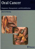 سرطان دهان | Oral Cancer : Diagnosis, Management, and Rehabilitation2007