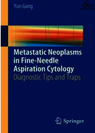 نئوپلاسم های متاستاتیک در سیتولوژی آسپیراسیون با سوزن ظریف | Metastatic Neoplasms in Fine-Needle Aspiration Cytology : Diagnostic Tips and Traps