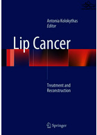 Lip Cancer : Treatment and Reconstruction | سرطان لب