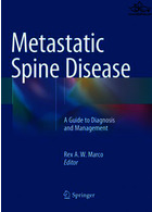 بیماری متاستاتیک ستون فقرات | Metastatic Spine Disease : A Guide to Diagnosis and Management