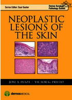 ضایعات نئوپلاستی پوست | Neoplastic Lesions of the Skin2014