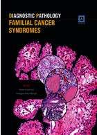 آسیب شناسی تشخیصی سندرم های سرطانی خانوادگی | Diagnostic Pathology: Familial Cancer Syndromes : Published by Amirsys