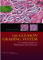 سیستم درجه بندی Gleason: راهنمای کامل برای پاتولوژیست و پزشکان | The Gleason Grading System : A Complete Guide for Pathologist and Clinicians