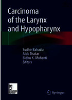 سرطان حنجره و هیپوفارنکس | Carcinoma of the Larynx and Hypopharynx