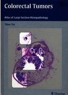 تومورهای کولورکتال | Colorectal Tumors : Atlas of Large Section Histopathology