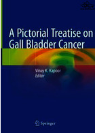 رساله تصویری درباره سرطان کیسه صفرا | A Pictorial Treatise on Gall Bladder Cancer2021