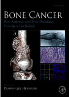 سرطان استخوان | Bone Cancer : Bone Sarcomas and Bone Metastases From Bench to Bedside