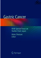 سرطان معده | Gastric Cancer : With Special Focus on Studies from Japan