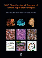 WHO Classification of Tumours of Female Reproductive Organs : WHO Classification of Tumours, Volume 6 | طبقه بندی تومورهای اندامهای تولید مثل زن