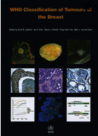 طبقه بندی تومورهای سینه | WHO Classification of Tumours of the Breast : WHO Classification of Tumours, Volume 4