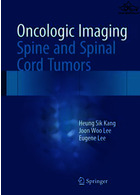تصویربرداری انکولوژیک | Oncologic Imaging: Spine and Spinal Cord Tumors