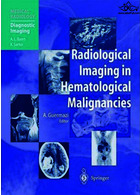 تصویربرداری رادیولوژیک در بدخیمی های هماتولوژیک | Radiological Imaging in Hematological Malignancies2004