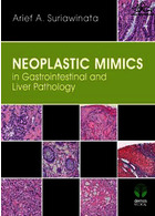 تقلید نئوپلاستی در آسیب شناسی دستگاه گوارش و کبد | Neoplastic Mimics in Gastrointestinal and Liver Pathology2014