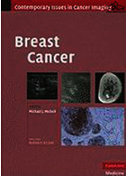سرطان پستان | Breast Cancer2010