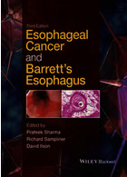 سرطان مری و مری بارت | Esophageal Cancer and Barrett's Esophagus2015