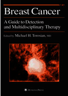 سرطان پستان | Breast Cancer : A Guide to Detection and Multidisciplinary Therapy