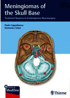 مننژیوم های پایه جمجمه | Meningiomas of the Skull Base : Treatment Nuances in Contemporary Neurosurgery2018