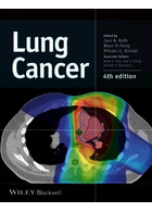 سرطان ریه | Lung Cancer2014