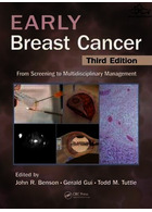 سرطان پستان اولیه | Early Breast Cancer : From Screening to Multidisciplinary Management, Third Edition