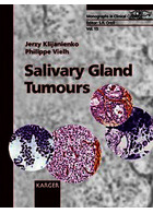 تومورهای غدد بزاقی | Salivary Gland Tumours2000