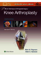 Master Techniques in Orthopedic Surgery: Knee Arthroplasty2019 | تکنیک های کارشناسی ارشد در جراحی ارتوپدی