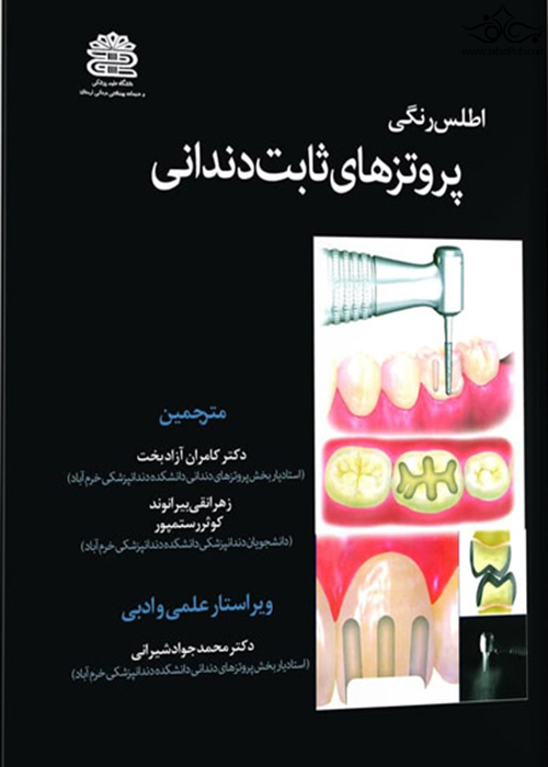 اطلس رنگی پروتز های ثابت دندانی دکتر کامران آزاد بخت جلد 1 آرتین طب