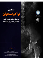 سنجش تراکم استخوان