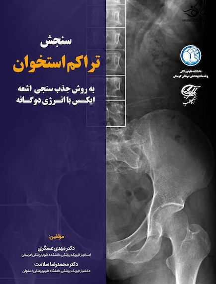 سنجش تراکم استخوان