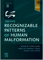 Smith's Recognizable Patterns of Human Malformation2021 | الگوهای قابل تشخیص ناهنجاری انسان اسمیت
