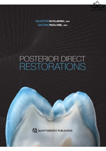 Posterior Direct Restorations 1st Edition  Quintessence Publishing Co Inc.,U.S
