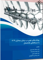 رویکردهای نوین در درمان بیماران cl II با دستگاه های فانکشنال