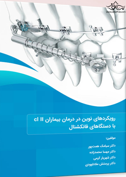 رویکردهای نوین در درمان بیماران cl II با دستگاه های فانکشنال