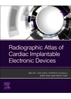 Radiographic Atlas of Cardiac Implantable Electronic Devices2021 | اطلس رادیوگرافی دستگاه های الکترونیکی  قلب