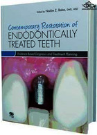 Contemporary Restoration of Endodontically Treated Teeth | ترمیم معاصر دندان های درمان شده با ریشه