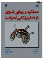 عملکرد و زیبایی فوری در دندانپزشکی ایمپلنت