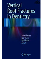 Vertical Root Fractures in Dentistry | شکستگی عمودی ریشه در دندانپزشکی