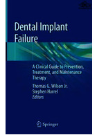 Dental Implant Failure : A Clinical Guide to Prevention, Treatment, and Maintenance Therapy | شکست ایمپلنت دندانی