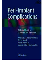 Peri-Implant Complications : A Clinical Guide to Diagnosis and Treatment | عوارض پری ایمپلنت