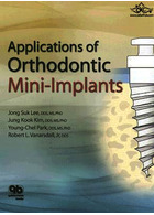 Applications of Orthodontic Mini Implants | کاربردهای مینی ایمپلنت ارتودنسی
